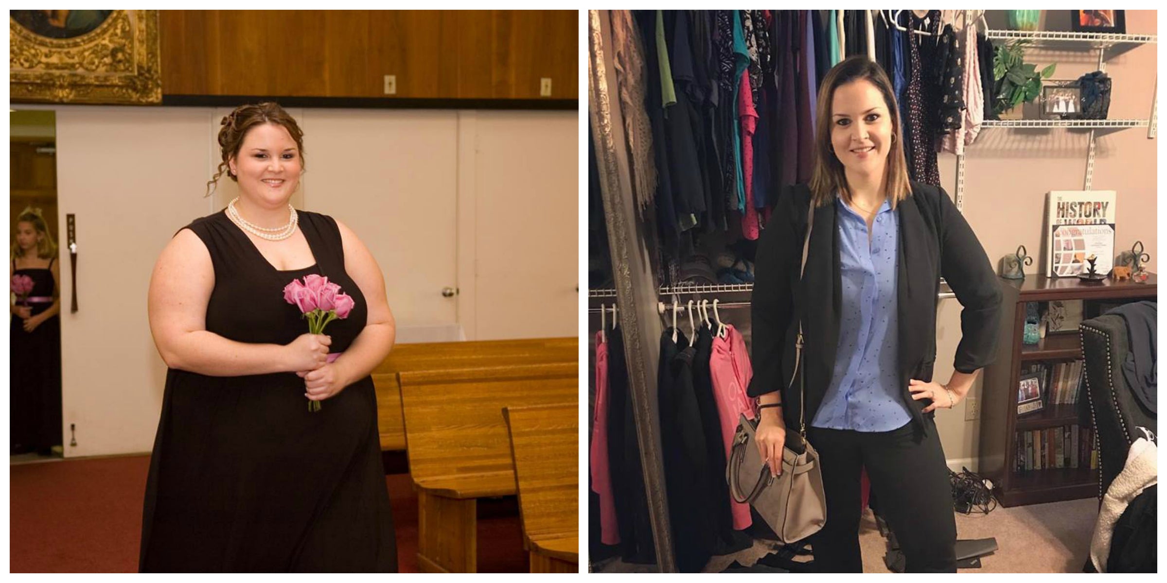 Kimberly H. Shares Her Weight Loss Surgery Transformation Story