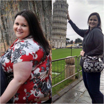 Kim's Journey: Losing & Regaining Weight after Bariatric Surgery